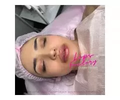 Cosmetology, lip augmentation - 4