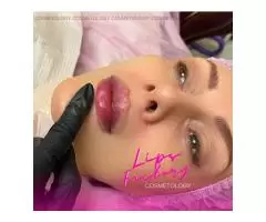 Cosmetology, lip augmentation - 8