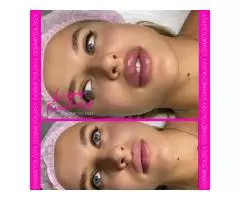 Cosmetology, lip augmentation - 11
