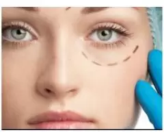 DERMAL FILLERS - 1